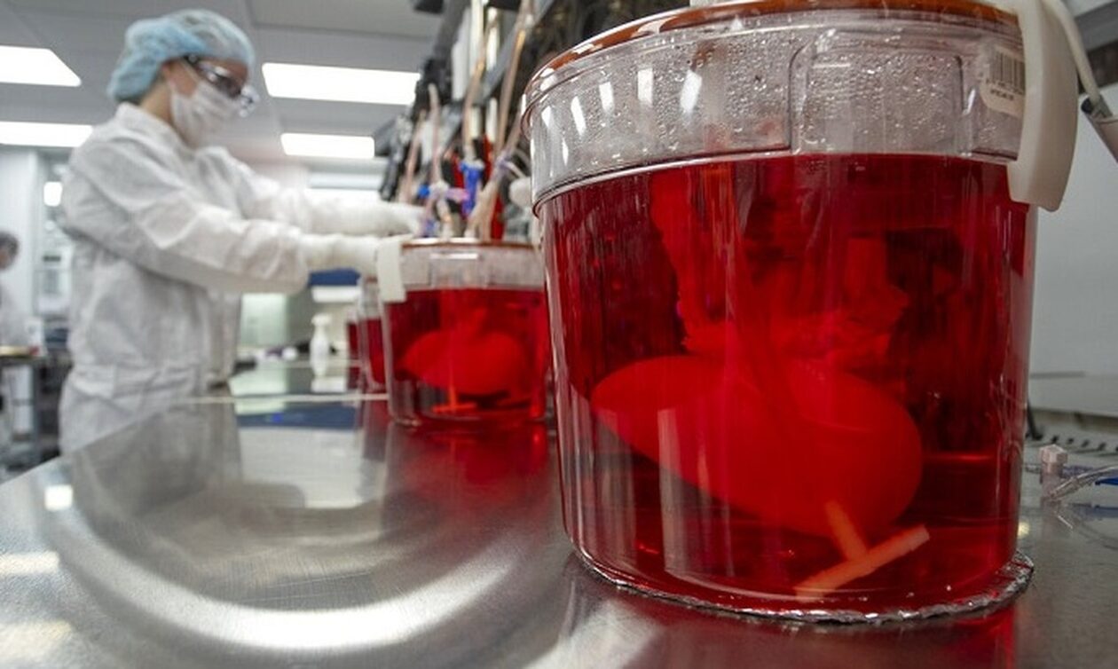 Πούλησαν τα νεφρά 122 ανθρώπων έναντι 9000 ευρώ το ένα: Δώδεκα συλλήψεις στην Ινδονησία