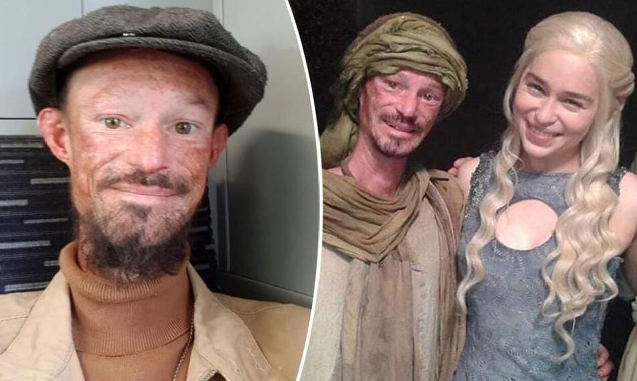 Πέθανε ο ηθοποιός του Game of Thrones Ντάρεν Κεντ, σε ηλικία 36 ετών