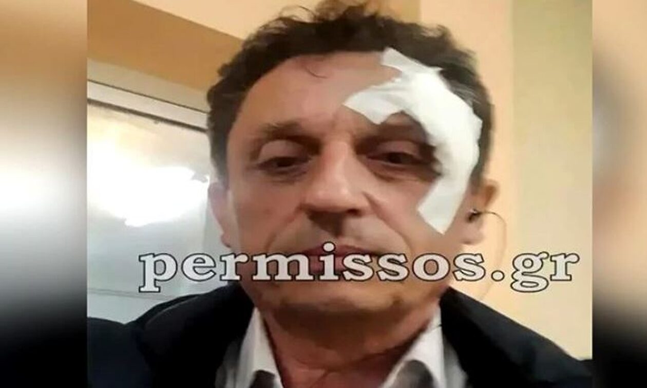 Βοιωτία: Με ράμματα ο δήμαρχος Αλιάρτου έπειτα από τα επεισόδια για τον θάνατο του 17χρονου Ρομά