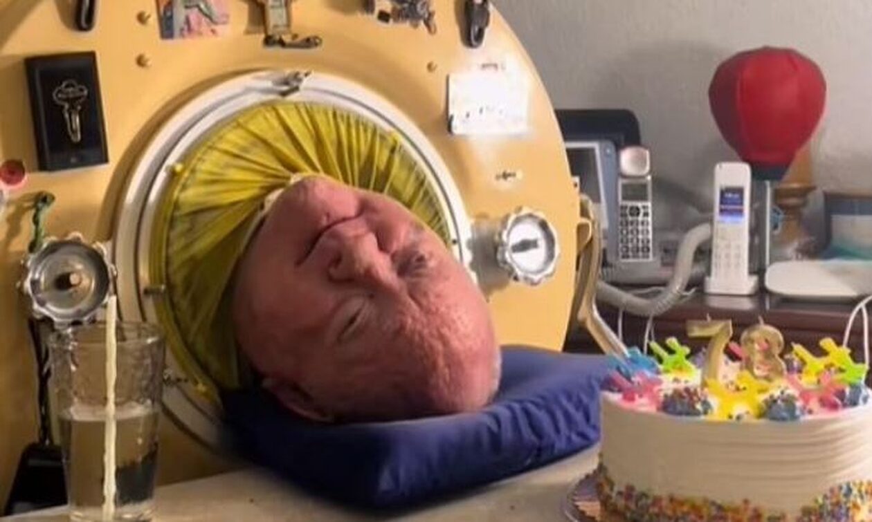 Πέθανε ο άνδρας που έζησε 70 χρόνια σε έναν σιδερένιο πνεύμονα – Η εκπληκτική ζωή του «Polio Paul»