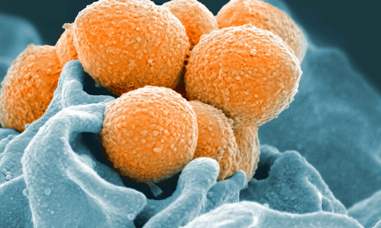 Μυστήριο στην Ιαπωνία: Ραγδαία αύξηση κρουσμάτων στρεπτόκοκκου – Τι φοβούνται οι επιστήμονες