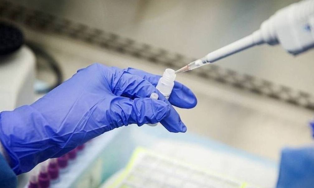Ανησυχία για τον ιό Μάρμπουργκ που σήμανε συναγερμό στο Αμβούργο – Θανατηφόρα ασθένεια
