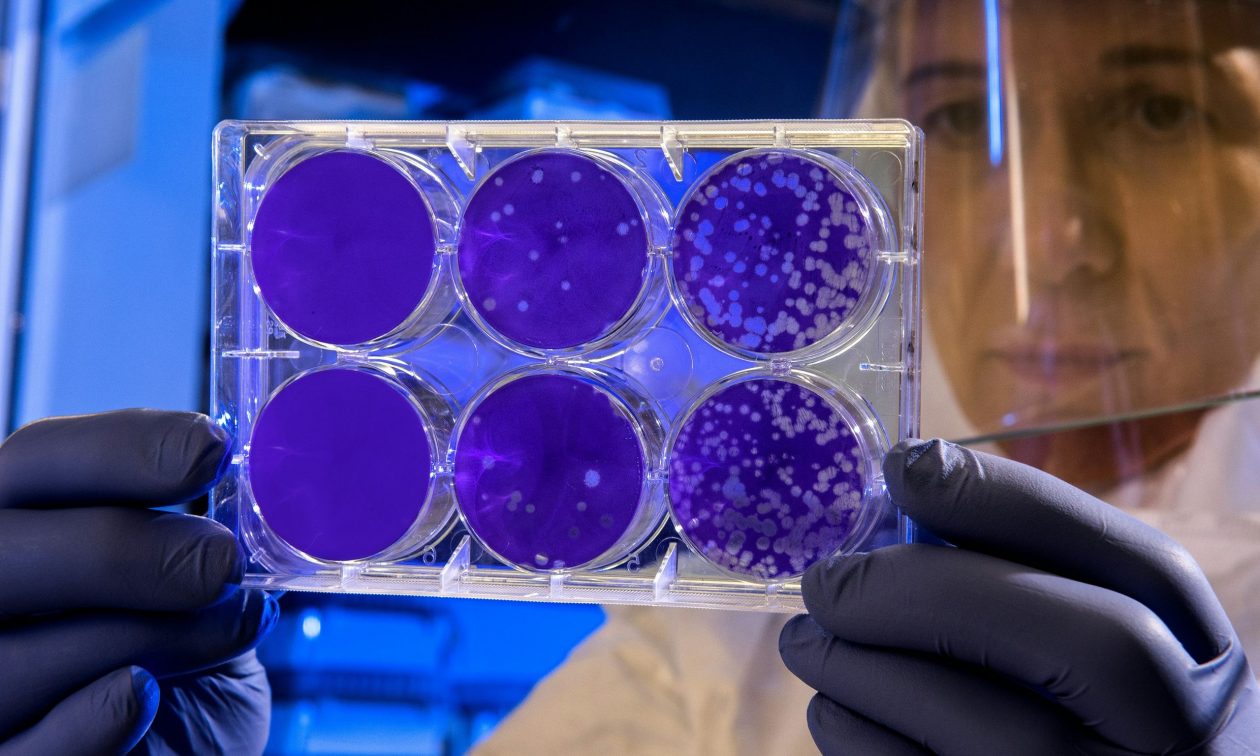 Γυναίκα έκανε για πλάκα τεστ DNA – Ανακάλυψε τη δραματική ιστορία της γιαγιάς της