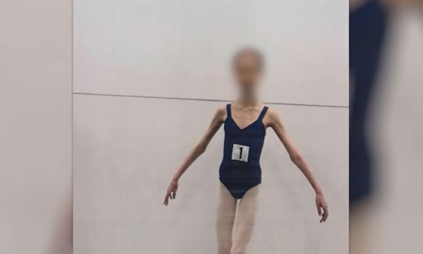 Αυστραλία: Στη φυλακή γονείς μπαλαρίνας που στα 17 της ζύγιζε μόλις 27 κιλά