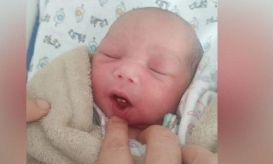 Βραζιλία: Μωρό γεννήθηκε με δύο δόντια – Το σπάνιο φαινόμενο και η αντίδραση της οικογένειάς του