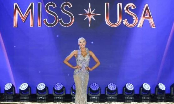 Μiss USA: Διαγωνιζόμενη με αλωπεκία πέταξε την περούκα και έγραψε ιστορία – Η viral στιγμή