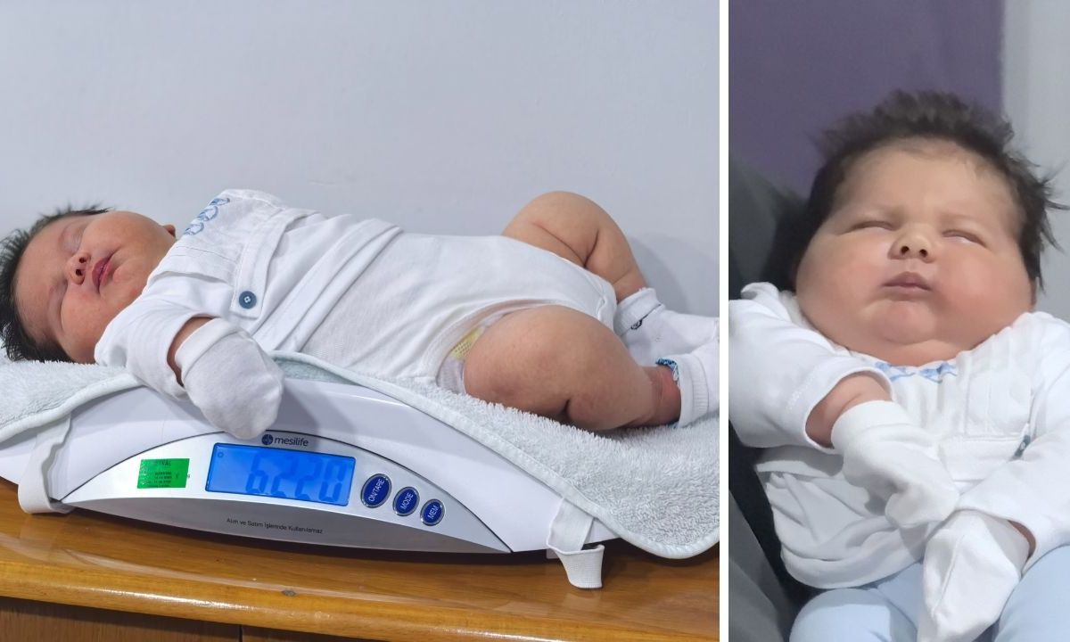 Αυτό είναι το μεγαλύτερο μωρό στην Τουρκία: Γεννήθηκε 6 κιλά και 150 γραμμάρια και ύψος 59 εκατοστά