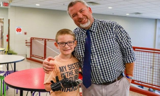 Δάσκαλος έκανε το θαύμα του: Σχεδίασε πρόσθετο χέρι για ΑμεΑ μαθητή με κόστος… 30 δολάρια