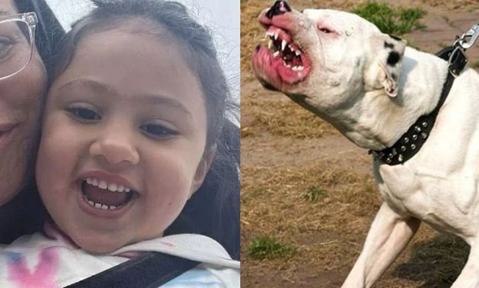 Παρ’ολίγον τραγωδία: Pit bull επιτέθηκε σε 4χρονη – Της «έσκισε» το πρόσωπο – Σκληρές εικόνες