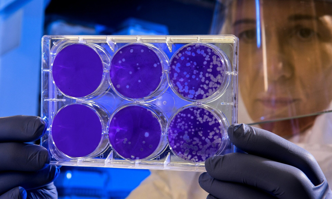 Ιός που αντέχει στο ανοσοποιητικό μπορεί να οδηγήσει σε πανδημία χειρότερη από την COVID