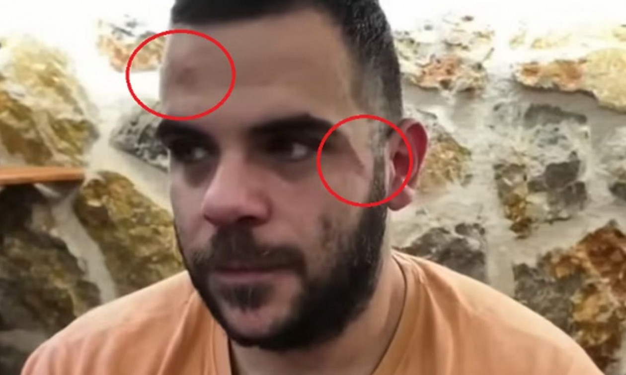 Γνωστός Youtuber από τη Θεσσαλονίκη δέχθηκε επίθεση σε ζωντανή μετάδοση