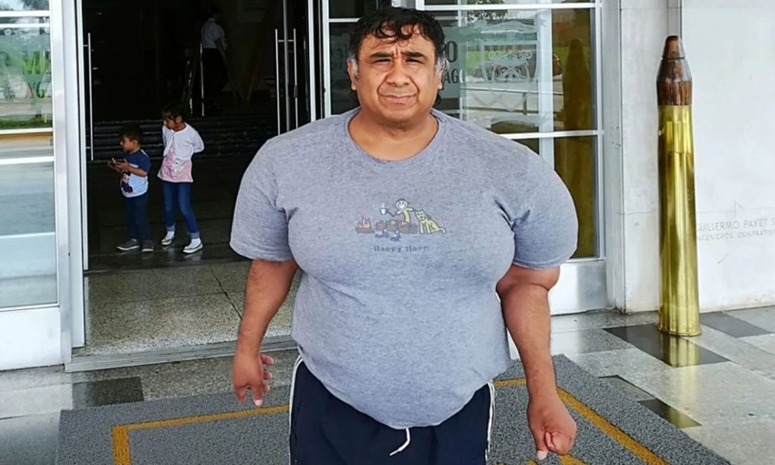 Περού: Δύτης έχει «φυσαλίδες αζώτου» στο σώμα εδώ και 11 χρόνια – «Ζω σαν φουσκωμένο μπαλόνι»