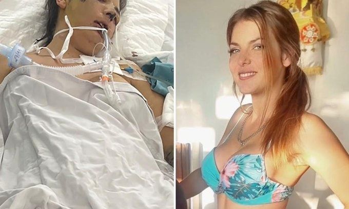 Χαροπαλεύει 31χρονη μητέρα τριών παιδιών μετά από αισθητική επέμβαση στο Βιετνάμ