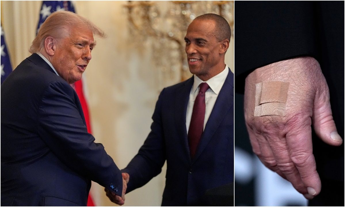 Ντόναλντ Τραμπ: Ανησυχία και πάλι για την υγεία του – Νέα καρέ με τσιρότα στο χέρι του