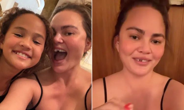Chrissy Teigen: Έσπασε το μπροστινό της δόντι με ζαχαρωτά παίζοντας με τα μικρά παιδιά της