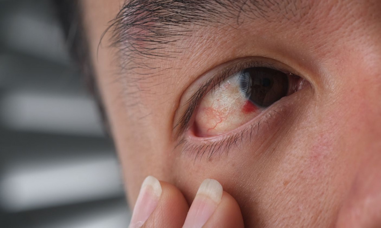 Χανιά: Νεαρός τραυματίστηκε σοβαρά στο μάτι – Η σωτήρια επέμβαση των γιατρών