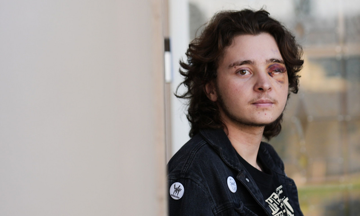 Καλιφόρνια: Πράκτορας της ICE πυροβόλησε διαδηλωτή στο πρόσωπο με βλήμα – Δείτε βίντεο