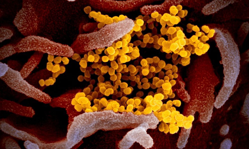 Πρώτος θάνατος εξαιτίας του ιού Nipah στο Μπαγκλαντές – Μεγάλη ανησυχία μετά τα κρούσματα στην Ινδία