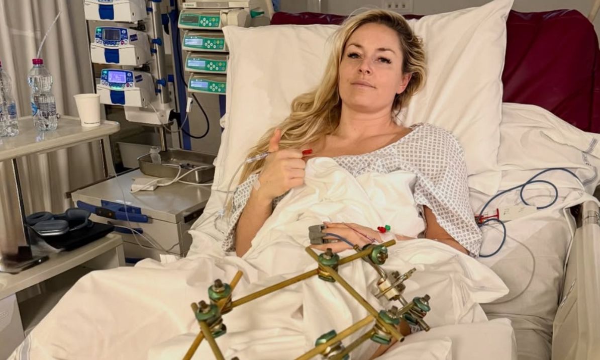 Λίντσεϊ Βον: «Πρώτος στόχος να κρατήσει το πόδι της» λένε οι γιατροί για το σοκαριστικό ατύχημα