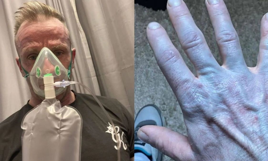 Ξύπνησε και ήταν όλος μπλε: Όταν πήγε στο νοσοκομείο οι γιατροί έκλαψαν από τα γέλια