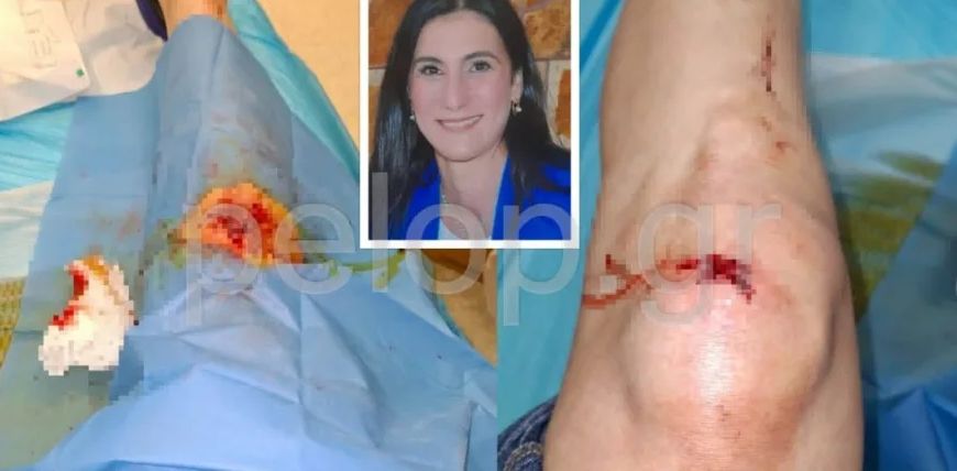 Πάτρα: Άγριος ξυλοδαρμός γυναίκας – Την ξυλοκόπησαν και την πέταξαν σε χαντάκι