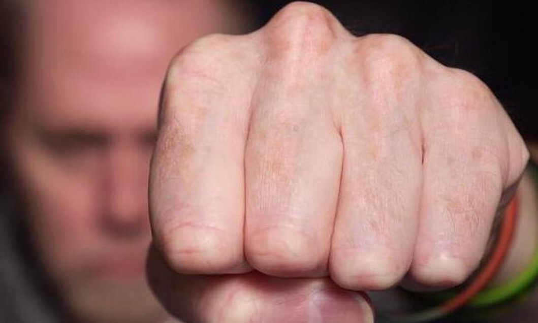 Παιανία: Άγριος ξυλοδαρμός ανήλικων από ομάδα 30 ατόμων – Χτύπησαν 17χρονο με ρόπαλο στο κεφάλι