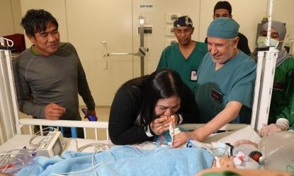 Σιαμαία από τις Φιλιππίνες χωρίστηκαν μετά από 6ωρη επέμβαση στη Σαουδική Αραβία