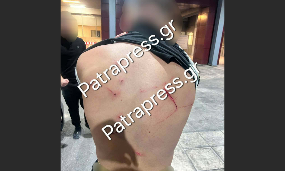 Ρίο: Χτύπησαν 18χρονο με κατσαβίδι 13 φορές και πήγαν να τον πετάξουν στη θάλασσα – Εικόνα
