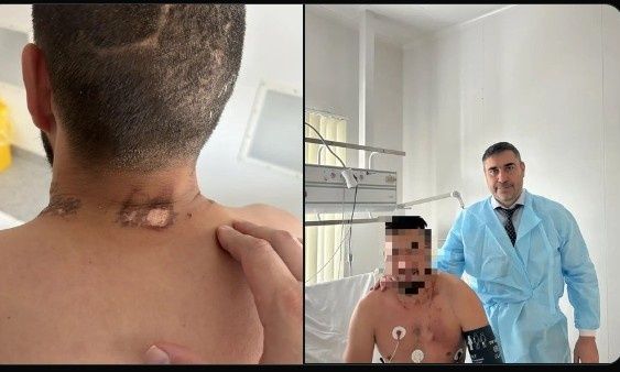 Η απίστευτη ιστορία ενός Ρώσου πεζοναύτη:  Επέζησε από κεραυνό, αρκούδα και άλογο…