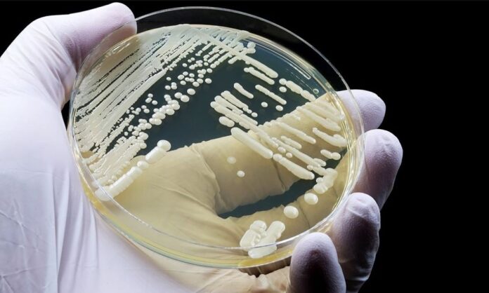 1754930-ba1f37dc-candida-auris.jpg