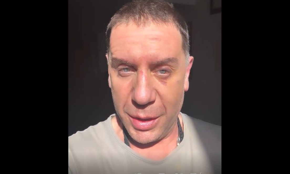 Γεωργιάδης: «Ο Μαζωνάκης υπέστη ανακοπή σε υποτιθέμενη κλινική – Σε διαδικασία πλασμαφαίρεσης»